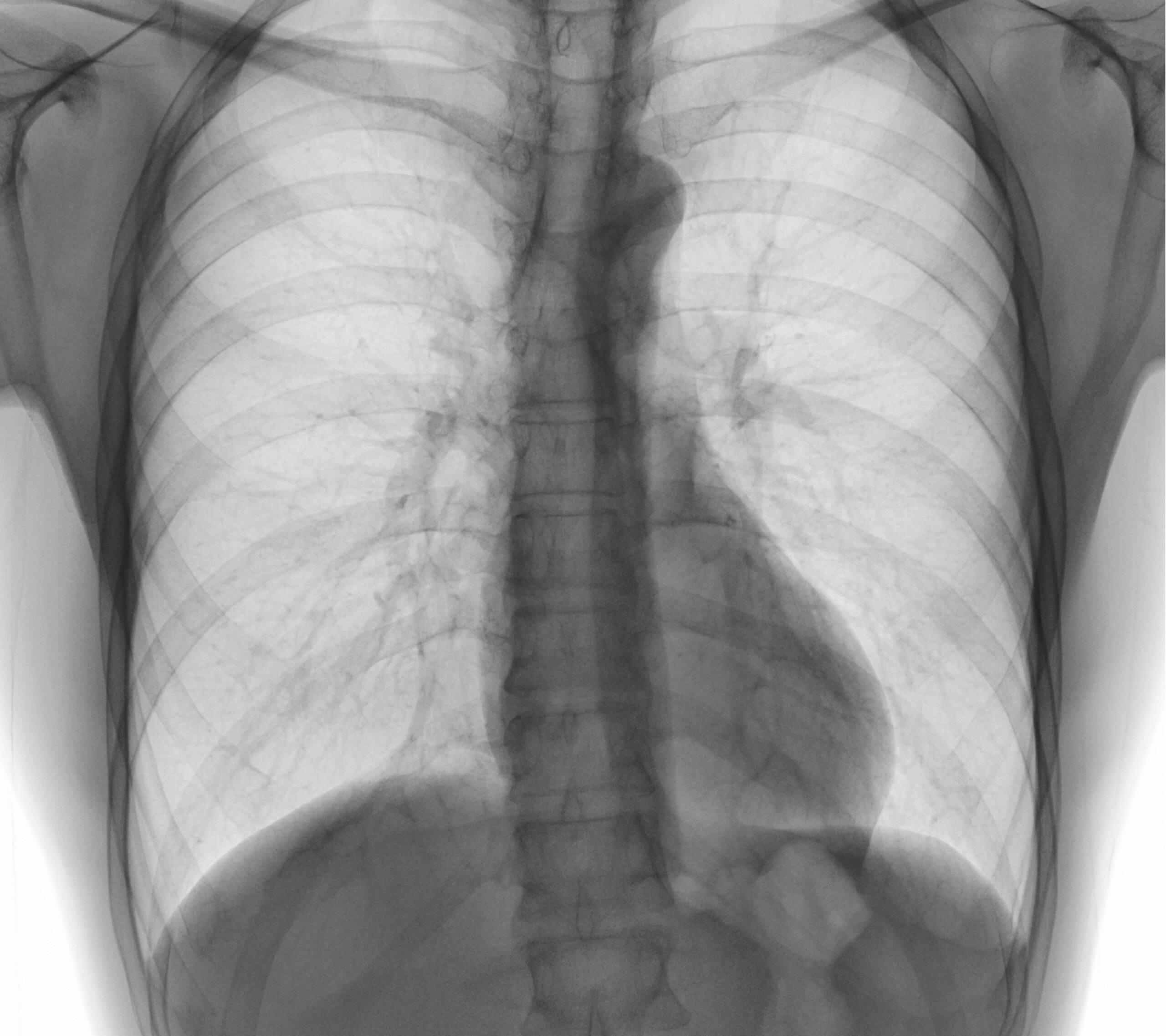 AeroDR 1417 HD3 (G5), Wireless Digital Radiography System