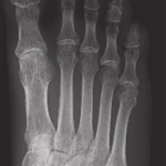 AeroDR 1417 HD3 (G5), Wireless Digital Radiography System