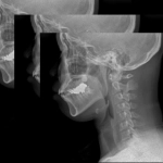 AeroDR TX, Φορητό Ψηφιακό Ηλεκτροκίνητο Ακτινολογικό Σύστημα