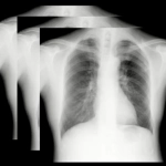 AeroDR TX, Φορητό Ψηφιακό Ηλεκτροκίνητο Ακτινολογικό Σύστημα