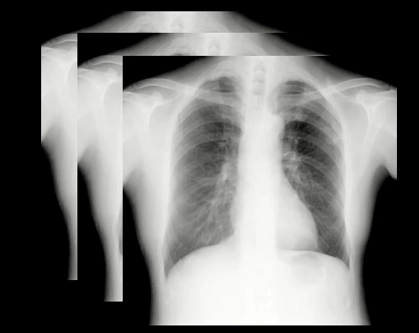 AeroDR TX, Φορητό Ψηφιακό Ηλεκτροκίνητο Ακτινολογικό Σύστημα