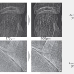 AeroDR 1417 HD3 (G5), Wireless Digital Radiography System