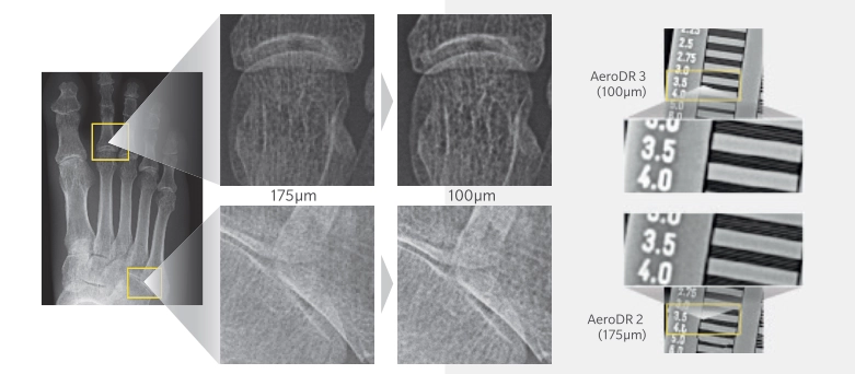 AeroDR 1417 HD3 (G5), Wireless Digital Radiography System