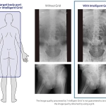 AeroDR 3 1417SL, Wireless Digital Radiography System