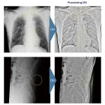 AeroDR 3 1417SL, Wireless Digital Radiography System