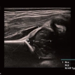 Υπέρηχος Mindray Consona N9