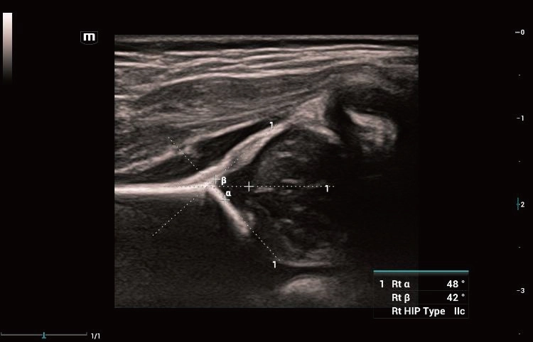 Υπέρηχος Mindray Consona N9