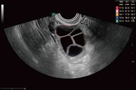 Υπέρηχος Mindray Consona N9