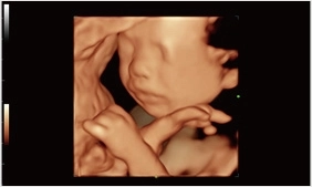 Υπέρηχος Mindray Consona N9