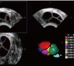 Υπέρηχος Mindray Consona N9