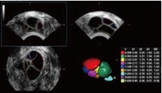 Υπέρηχος Mindray Consona N9