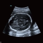 Υπέρηχος Mindray Consona N9