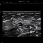 Υπέρηχος Mindray Consona N9