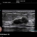 Υπέρηχος Mindray Consona N9