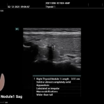 Υπέρηχος Mindray Consona N9