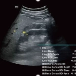 Υπέρηχος Mindray Consona N9