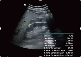 Υπέρηχος Mindray Consona N9