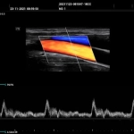 Υπέρηχος Mindray Consona N9