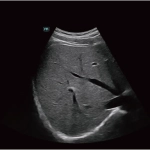 Υπέρηχος Mindray Consona N9