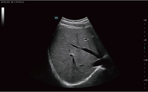 Υπέρηχος Mindray Consona N9