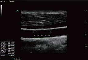 Υπέρηχος Mindray Consona N9