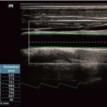 Υπέρηχος Mindray Consona N9