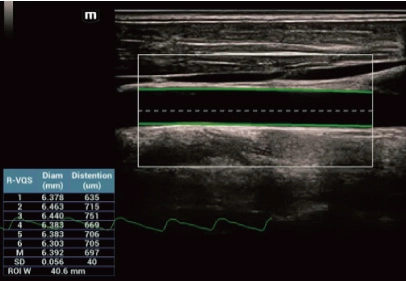 Υπέρηχος Mindray Consona N9