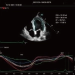 Υπέρηχος Mindray Consona N9