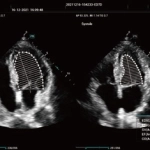 Υπέρηχος Mindray Consona N9