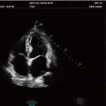 Υπέρηχος Mindray Consona N9