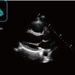 Υπέρηχος Mindray Consona N9