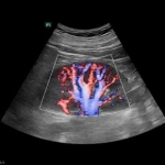 Υπέρηχος Mindray Consona N9