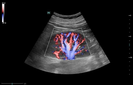 Υπέρηχος Mindray Consona N9