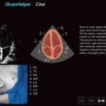 Υπέρηχος Mindray Consona N9