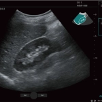 Υπέρηχος Mindray Consona N9