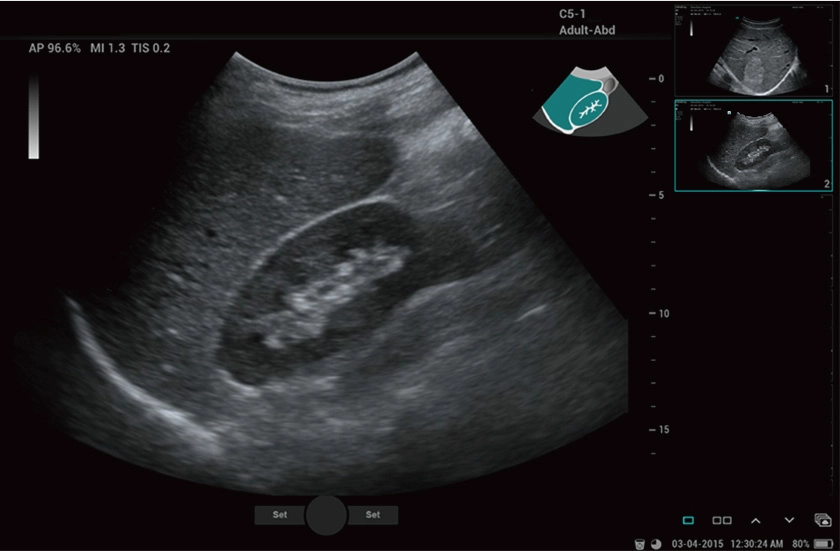 Υπέρηχος Mindray Consona N9