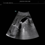 Υπέρηχος Mindray Consona N9