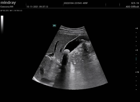 Υπέρηχος Mindray Consona N9