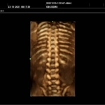 Υπέρηχος Mindray Consona N9