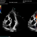 Υπέρηχος Mindray Consona N9