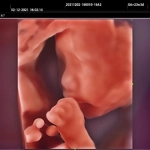 Υπέρηχος Mindray Consona N9