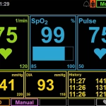 Defibrillator-Monitor MEDUCORE Standard