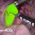 System green – Σύστημα φθορίζουσας απεικόνισης ICG/NIR