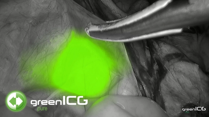 System green – Σύστημα φθορίζουσας απεικόνισης ICG/NIR