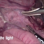 System green – Σύστημα φθορίζουσας απεικόνισης ICG/NIR