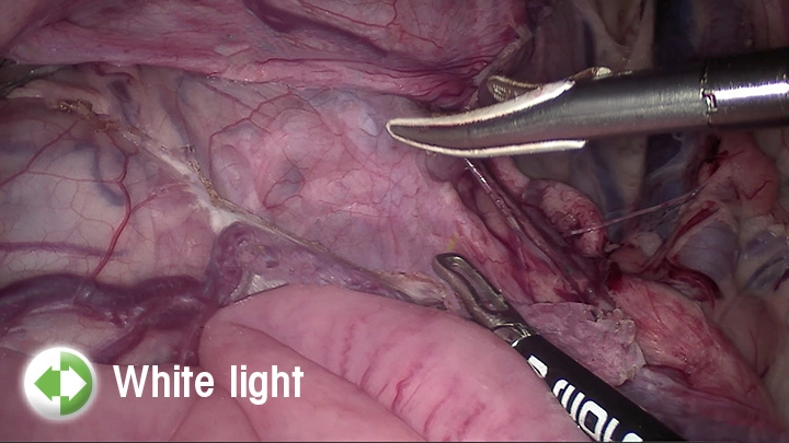 System green – Σύστημα φθορίζουσας απεικόνισης ICG/NIR