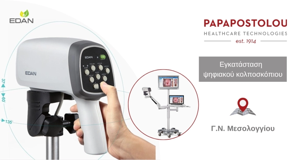 Εγκατάσταση ψηφιακού κολποσκόπιου στο Γ.Ν. Μεσολογγίου