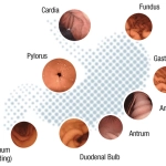 Κάψουλα Στομάχου Navicam Xpress