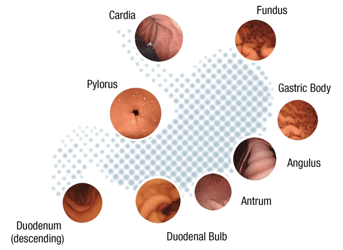 Κάψουλα Στομάχου Navicam Xpress