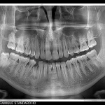 Πανοραμικό σύστημα CBCT I-MAX 3D CEPH PRO